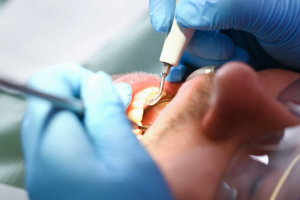Best Emergency Treatment for Dental Infections or Abscesses in Semmes, AL